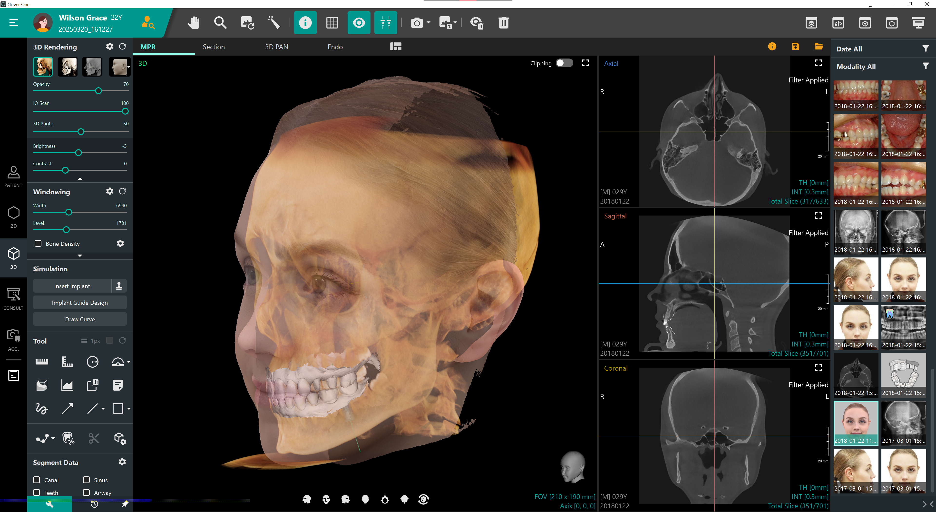 Clever One UI Interface