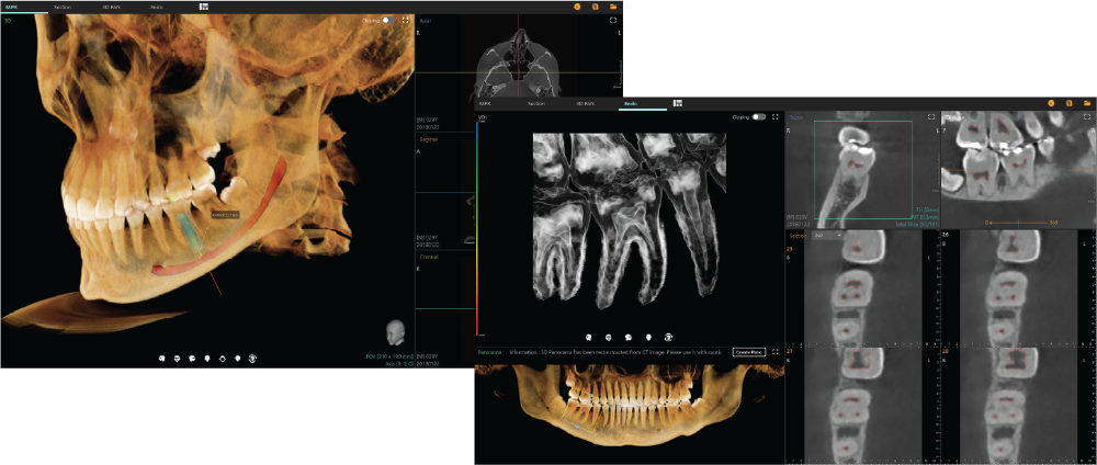 Effective Simulation